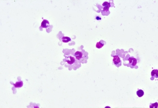 Hematological staining of cells in a monocyte monolayer assay performed using sub-optimal conditions. 