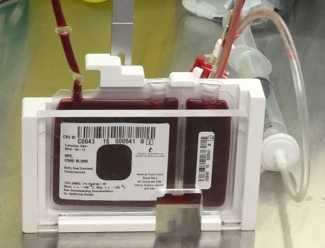 Cord Blood Unit