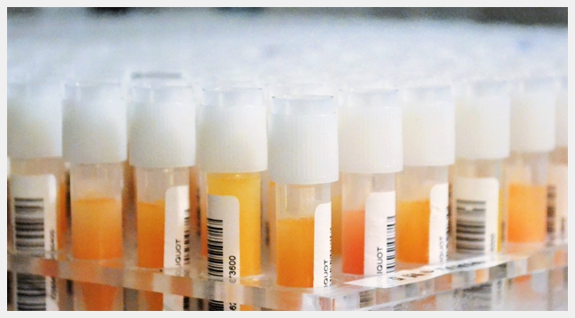 Image of vials of plasma being prepared for testing with orange substance in the tubes.